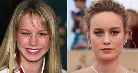 did brie larson have a boob job|Brie Larson’s Plastic Surgery – What We Know So Far